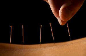 Fingers Manipulating Acupuncture Needle